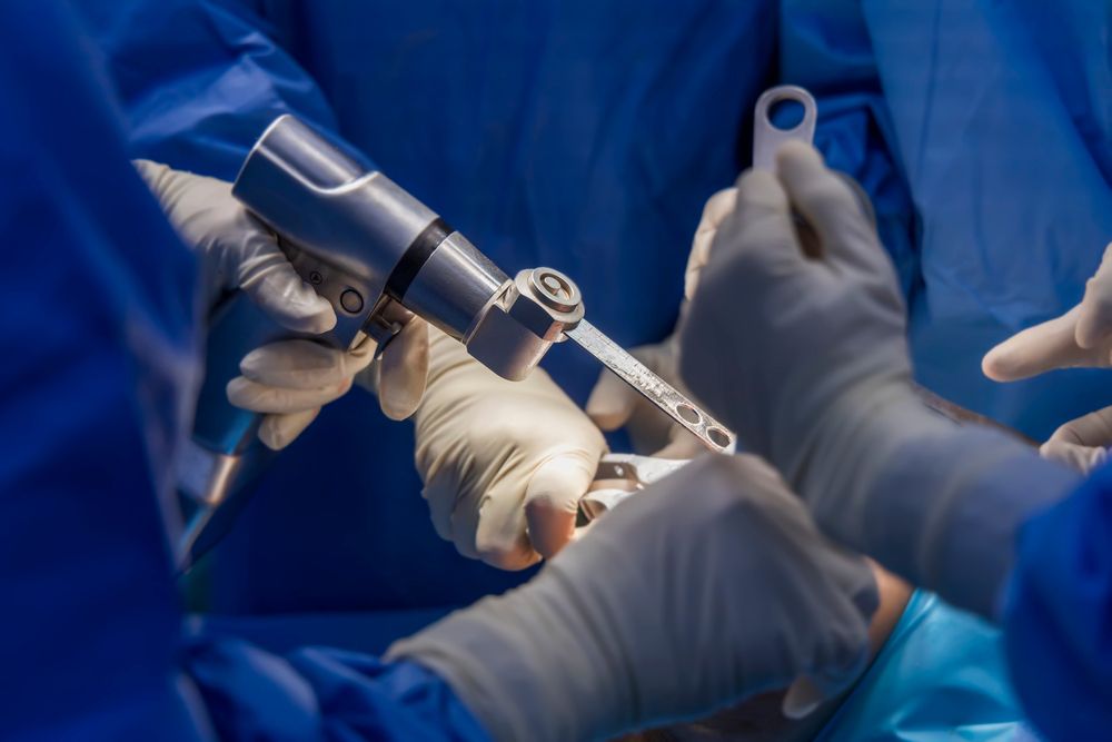 Smart Implant sensors in orthopedic surgery