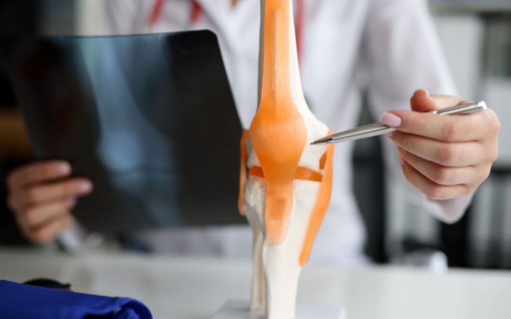 Doctor Showing Knee Arthritis Model